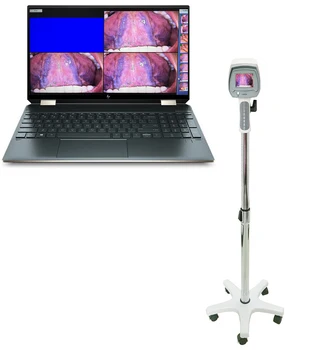 Hot müük günekoloogilise enese-kontroll endoscope digitaalne kaasaskantav elektrooniline colposcope